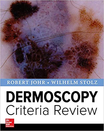 Dermoscopy Criteria Review