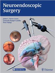 Cover Neuroendoscopic Surgery
