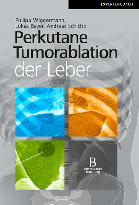 Perkutane Tumorablation der Leber