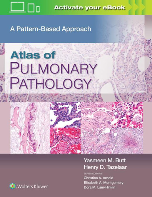 Atlas of Pulmonary Pathology