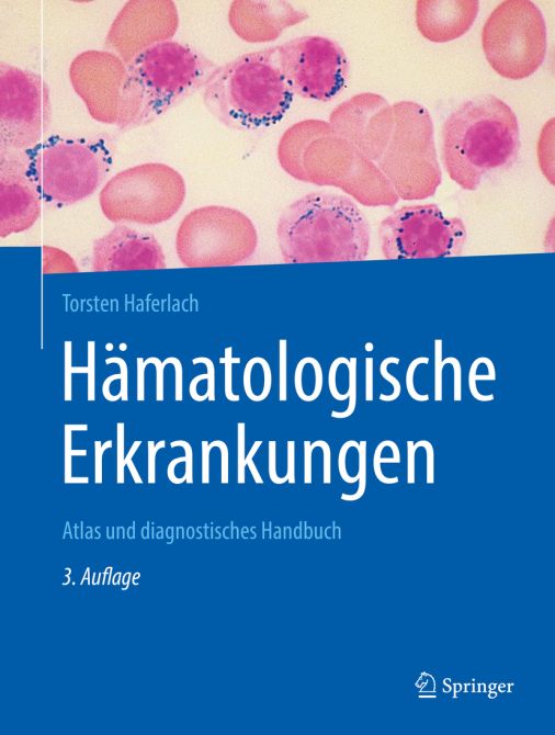 Hämatologische Erkrankungen