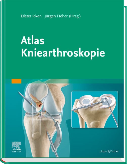 Atlas Kniearthroskopie