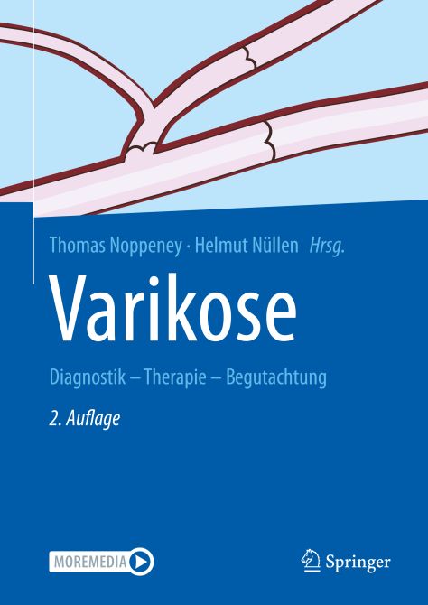 Varikose