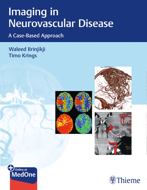 Imaging in Neurovascular Disease