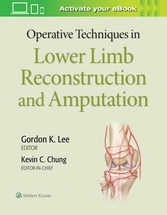 Operative Techniques in Lower Limb Reconstruction and Amputation