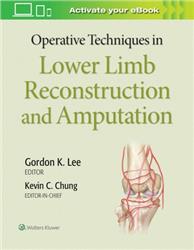 Cover Operative Techniques in Lower Limb Reconstruction and Amputation