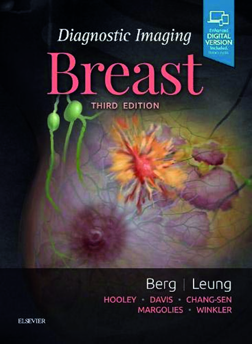 Diagnostic Imaging: Breast