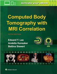 Cover Computed Body Tomography with MRI Correlation
