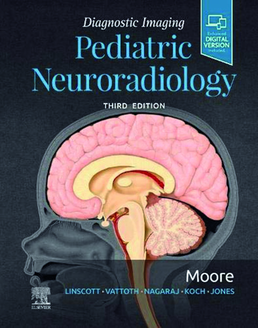 Diagnostic Imaging: Pediatric Neuroradiology