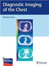 Cover Diagnostic Imaging of the Chest