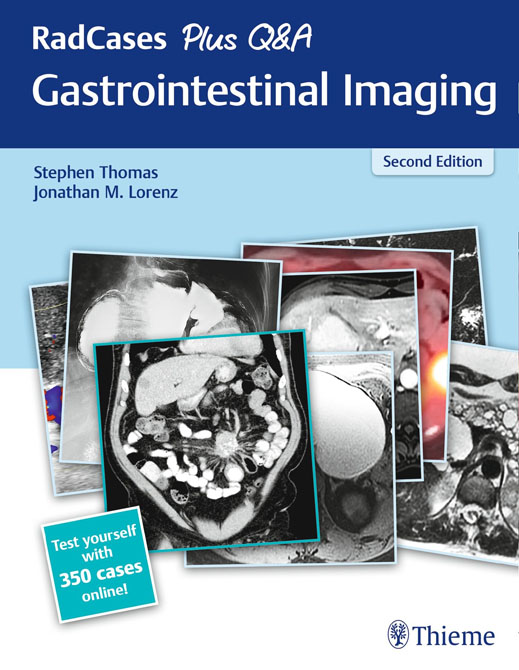Gastrointestinal Imaging - RadCases Plus Q&A