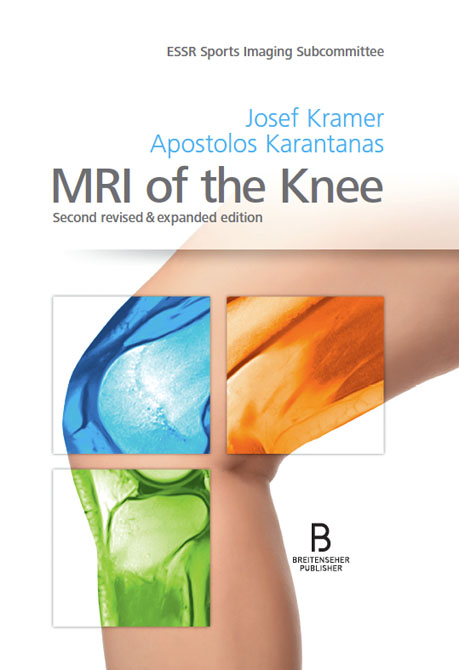 MRI of the Knee