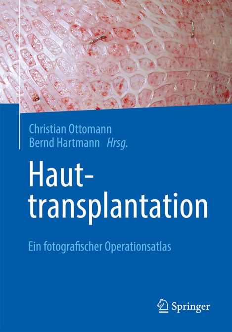 Hauttransplantation