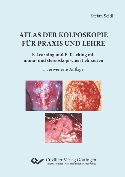 Atlas der Kolposkopie für Praxis und Lehre