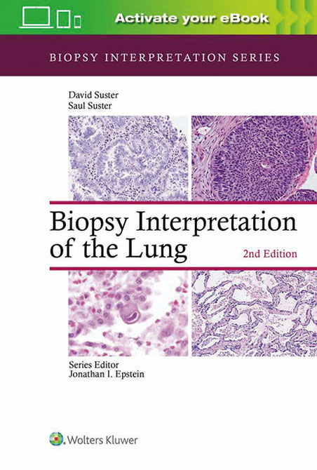 Biopsy Interpretation of the Lung