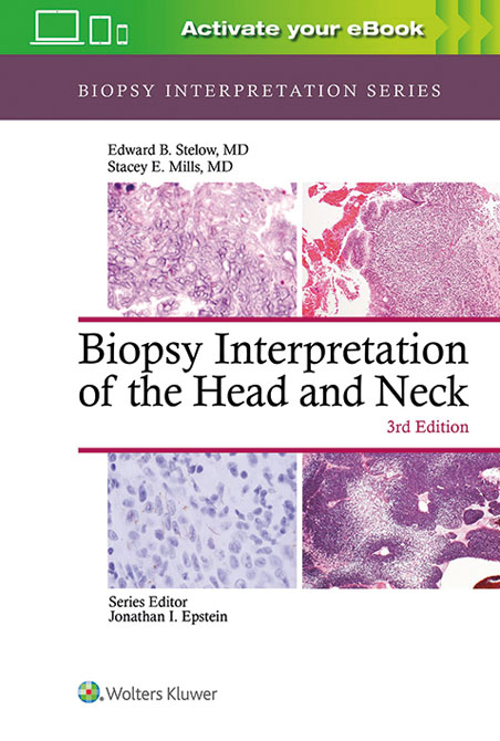 Biopsy Interpretation of the Upper Aerodigestive Tract and Ear