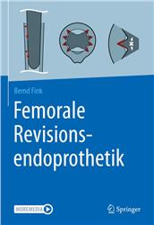 Cover Femorale Revisionsendoprothetik