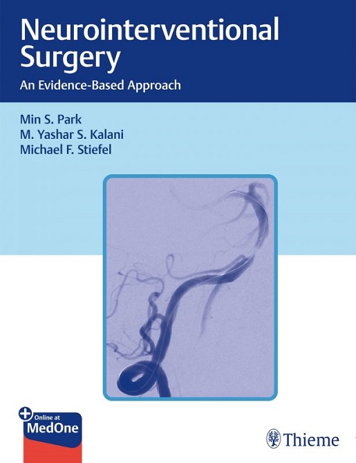 Neurointerventional Surgery