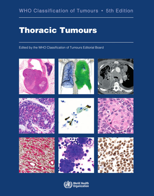 WHO Classification of Tumours. Thoracic Tumours