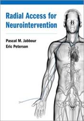 Cover Radial Access for Neurointervention