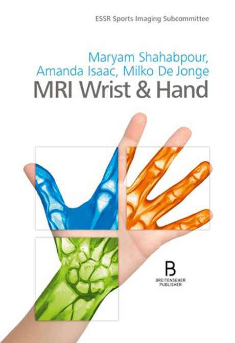 MRI Wrist & Hand