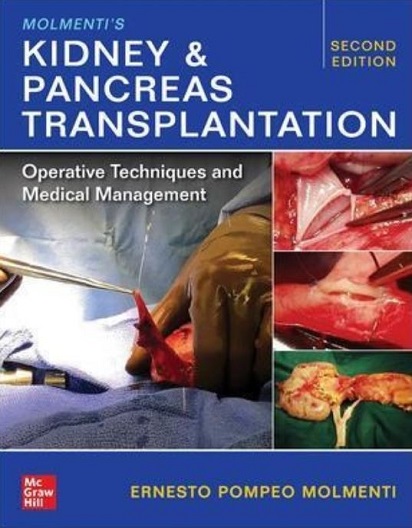 Kidney and Pancreas Transplantation.