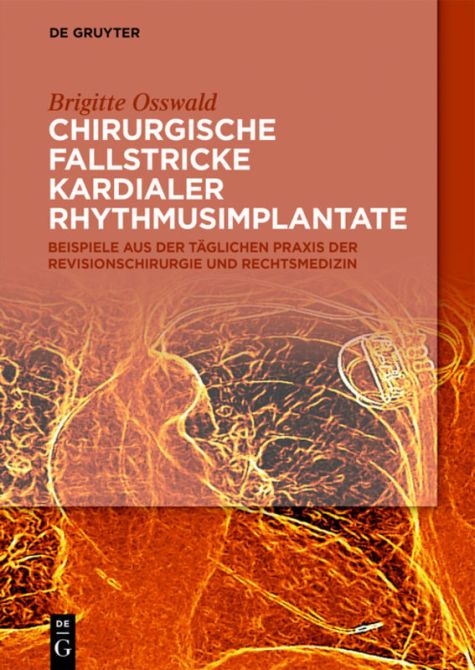 Chirurgische Fallstricke kardialer Rhythmusimplantate