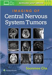 Cover Imaging of Central Nervous System Tumors