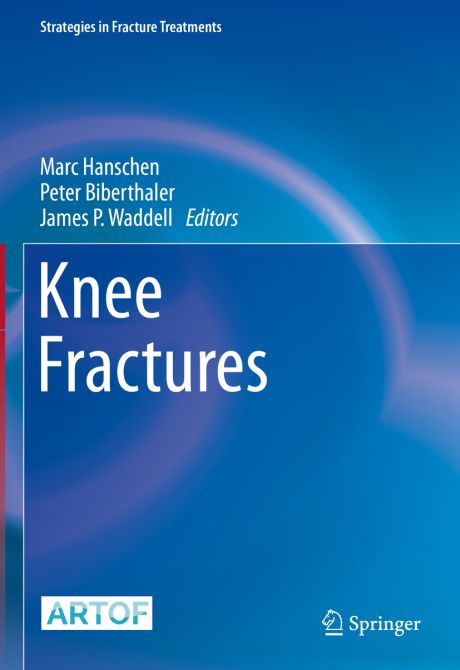 Knee Fractures