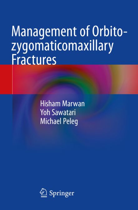 Management of Orbito-zygomaticomaxillary Fractures