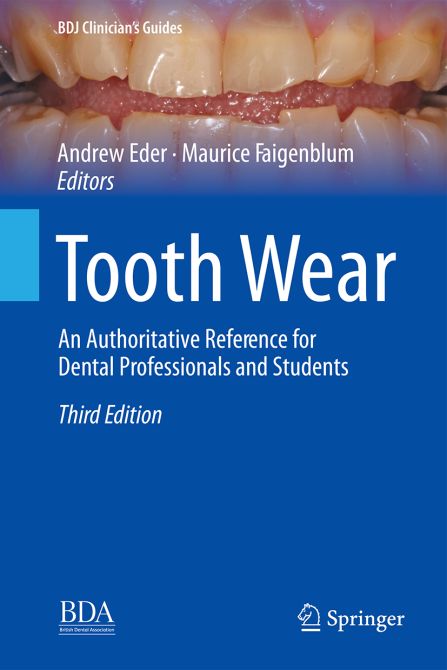 Tooth Wear