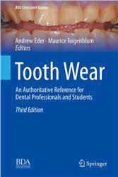 Cover Tooth Wear