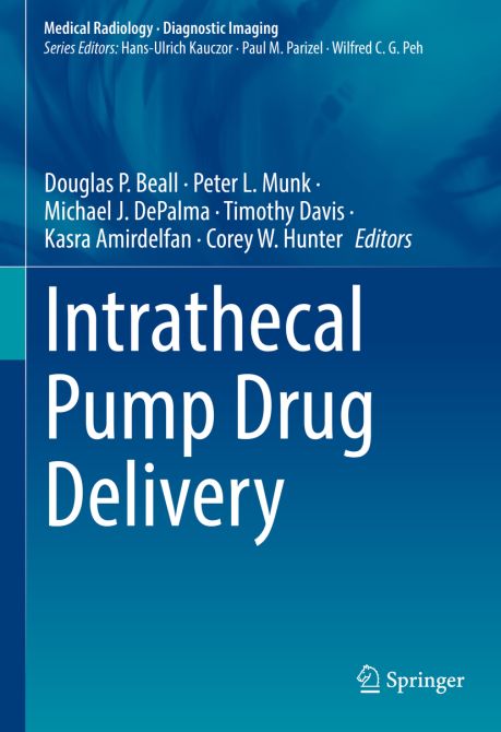 Intrathecal Pump Drug Delivery