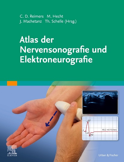 Atlas der Nervensonografie und Elektroneurografie