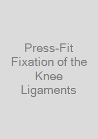 Cover Press-Fit Fixation of the Knee Ligaments