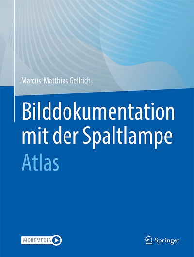 Bilddokumentation mit der Spaltlampe