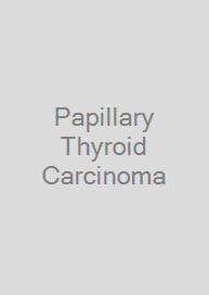 Papillary Thyroid Carcinoma