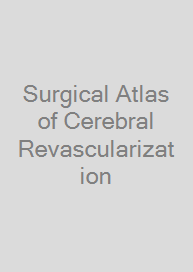 Surgical Atlas of Cerebral Revascularization