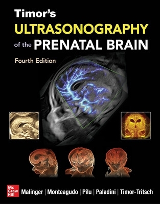 Ultrasonography of the Prenatal Brain