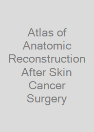 Cover Atlas of Anatomic Reconstruction After Skin Cancer Surgery