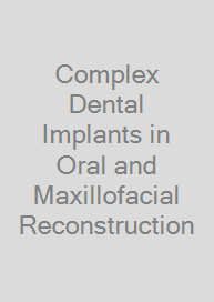 Complex Dental Implants in Oral and Maxillofacial Reconstruction