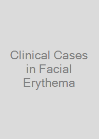 Cover Clinical Cases in Facial Erythema