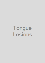 Tongue Lesions
