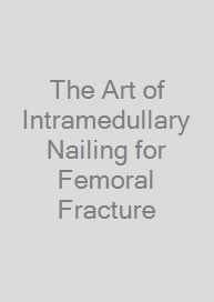 Cover The Art of Intramedullary Nailing for Femoral Fracture