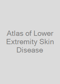 Cover Atlas of Lower Extremity Skin Disease