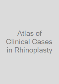 Cover Atlas of Clinical Cases in Rhinoplasty
