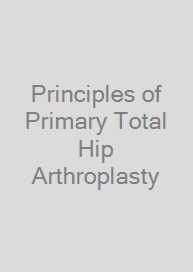 Cover Principles of Primary Total Hip Arthroplasty