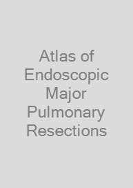 Cover Atlas of Endoscopic Major Pulmonary Resections