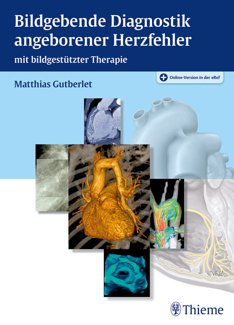 Bildgebende Diagnostik angeborener Herzfehler