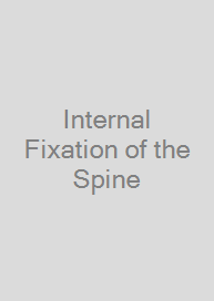 Cover Internal Fixation of the Spine
